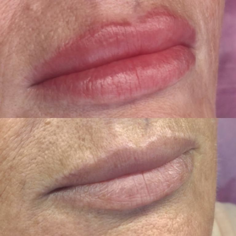 CosmeticLipBlushing_01